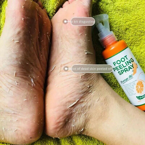 Jinyliving Foot Peeling Spray Improve Rough Skin Available For Whole Body - 100ml