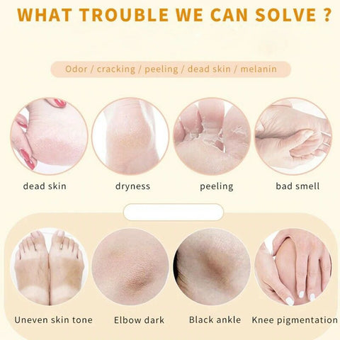 100ML Foot Peeling Spray Nourish Moisturizing Elbow Exfoliating Essence Dead Skin Remover Pedicure Foot Care Tool